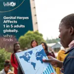 Genital Herpes Affects 1 in 5 Adults Globally, WHO Finds